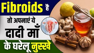 फाइब्रॉएड का देसी इलाज  Fibroid ke Gharelu Nuskhe  Natural Fibroid Remedies  Fibroid Treatment [upl. by Kakalina514]