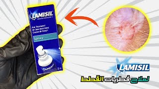 علاج فطريات القطط  Cat Fungus Treatment [upl. by Cirtemed]