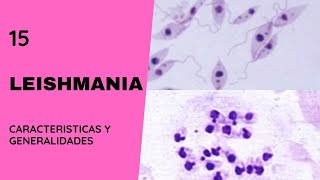 Leishmania 15  Leishmaniasis  Flagelados  Parasitosis [upl. by Enaud]