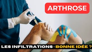 ARTHROSE  Les injections et infiltrations estce une bonne idée [upl. by Georgiana]