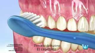 Cepillado seda dental y colutorios ¿cómo [upl. by Sherrill673]