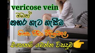 නහර ගැටගැසීමට විසදුම How to treat vericose vein [upl. by Drobman150]