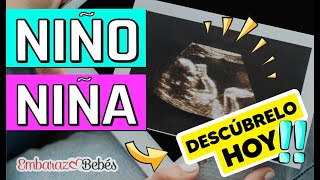 Cómo saber si es NIÑO o NIÑA por Ultrasonido  SEMANA 12 a 20 ¡Detecta las diferencias [upl. by Wilkinson112]