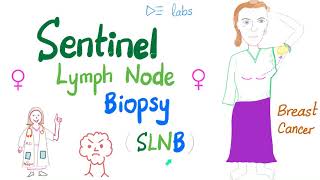 Sentinel Lymph Node Biopsy SLNB for Breast Cancer [upl. by Ileana]