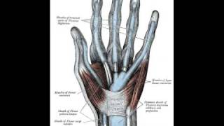 Flexor Tendon Sheath Infection [upl. by Sup]