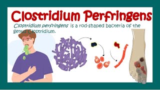 Clostridium Perfringens  Gas gangrene  What is the treatment for Clostridium perfringens [upl. by Rubliw851]