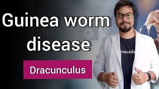 Guinea worm disease Dracunculiasis  Dracunculus [upl. by Cam]