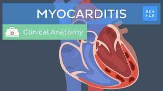 Myocarditis Causes symptoms diagnosis treatment and prognosis  Kenhub [upl. by Kipp]