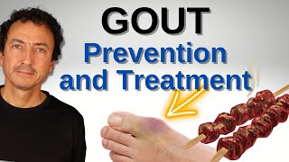 The Truth About Gout Prevention and Treatment [upl. by Ellerey]