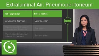 Extraluminal Air Pneumoperitoneum amp Pneumoretroperitoneum – Radiology  Lecturio [upl. by Ylatan919]