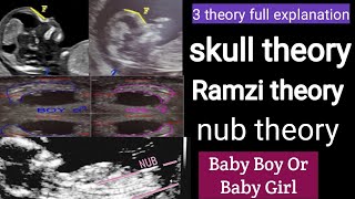 Boy or girl baby using theory skull nub and ramzi theory using scan reports its boy or girl [upl. by Saixela]