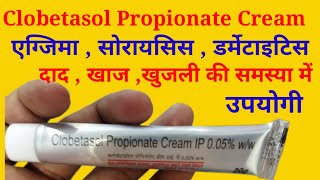 Clobetasol Propionate Cream Uses in Hindi  क्लोबेटासोल प्रोपियोनेट क्रीम के बारे में जानकारी [upl. by Chaille]