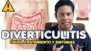 Dolor en lado izquierdo abdomen ¿Apendicitis o diverticulitis  Síntomas Diverticulitis [upl. by Retloc]