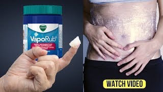 What Happens When You Use Vicks Vaporub  Unexpected Uses Of Vicks VapoRub [upl. by Sparrow822]