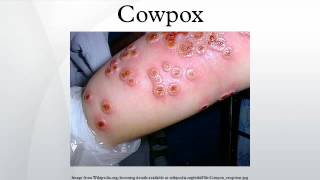 Cowpox [upl. by Berriman908]