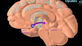 Webinar  Use of Buprenorphine in the Treatment of Opiate Dependence [upl. by Ecyak]