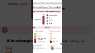 Serum vs plasma labtechnician medicallaboratorytechnician labtechnicianvacancy labtech [upl. by Novy561]