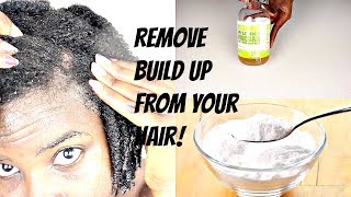 How To Clarify Your Hair And Scalp  Apple Cider Vinegar and Baking Soda [upl. by Atnicaj]