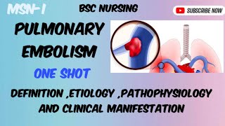 Pulmonary Embolism  part1 Bsc nursing semIII [upl. by Harod]