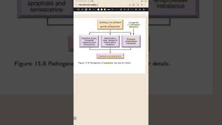 Pathogenesis of Emphysema [upl. by Ardnassela821]