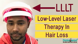 Low Level Laser Therapy For Hair Loss  LLLT Therapy For Hair Loss  Hair Fall Treatment LLLT [upl. by Ednyl]