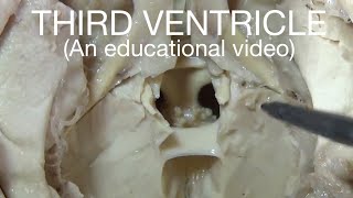 THIRD VENTRICLE  An educational video [upl. by Adnical]