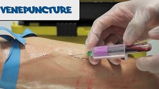 Venipuncture  How to take Blood  OSCE Guide old version  UKMLA  CPSA [upl. by Anade]