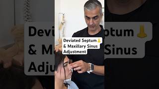 Deviated Septum amp Maxillary Sinus Adjustment chiropractic shorts [upl. by Coney809]