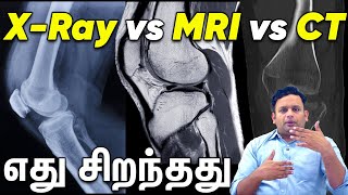 MRI vs CT vs XRay  Which is Better Dr Shriram Krishnamoorthy Tamil [upl. by Ecneralc495]