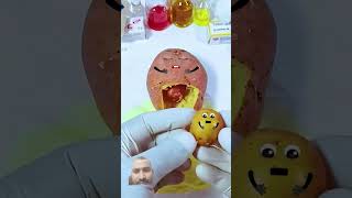 Food surgery mukbang funny satisfying food toys fruitsurgery patato [upl. by Donough]