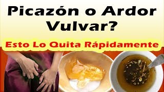 REMELDIOS CASEROS PARA PICAZON ARDOR VULVAR Como Quitar La Irritacion En Los Labios Genitales [upl. by Asilanom]