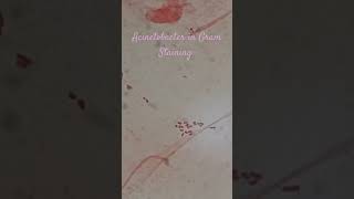 Gram negative bacteria in Gram Staining [upl. by Edalb]