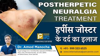 Postherpetic Neuralgia PHN Treatment  हर्पीस जोस्टर के दर्द का इलाज।by Dr Amod Manocha [upl. by Krissy]