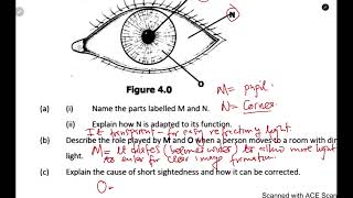 Biology  The eye exam question THE DIGITAL TUTOR [upl. by Nozicka]