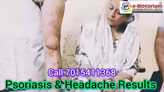 Ebiotorium Magnetic Mattress Result In Psoriasis amp Headache More Info Order amp Joining 917015411368 [upl. by Edge]