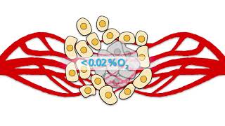 Hypoxia Inducible Factors HIFs Part 1 Tumor hypoxia [upl. by Otsuj]