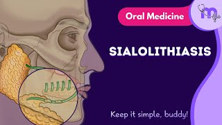 Sialolithiasis  Full Video  Oral Medicine  Medi Study Go [upl. by Eillam188]