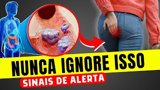 SINTOMAS de ALERTA de CÂNCER DE INTESTINO que você NUNCA PODE IGNORAR [upl. by Ennaer]