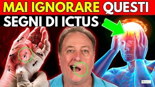 SEGNI PRECOCI di EMORRAGIA cerebrale ed ICTUS [upl. by Haldane]