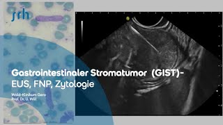 Gastrointestinaler Stromatumor  EUS FNP Zytologie [upl. by Aisya684]