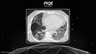 Precise IQ Engine PIQE with 1024 Matrix Overview [upl. by Moriah]