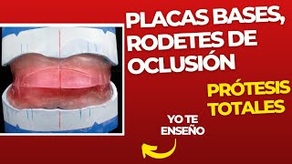 Placas bases rodetes de oclusión y contorno 👅 PASOS Prácticos ProtesisTotales [upl. by Schultz]