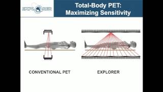 Simon Cherry EXPLORER  Changing the Molecular Imaging Paradigm with TotalBody PETCT [upl. by Zaria560]