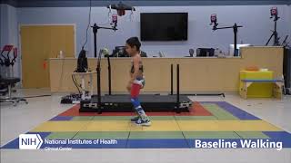 Robotic exoskeleton alleviates crouch gait in children with cerebral palsy [upl. by Henryson434]