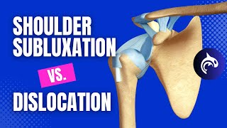 Shoulder Subluxation vs Shoulder Dislocation  3D animation [upl. by Anire939]