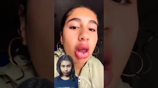 Part 2 🙏Viral Lip Plumping 💋trending viralshort yputubeshorts hacklipistichack [upl. by Tarrel]