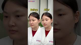 Notice the amazing skin and body transformation 😍 CavitationMachine FacialDevice AntiAging [upl. by Erelia246]