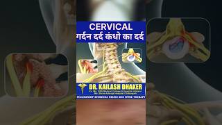 CERVICAL PAIN TREATMENT [upl. by Eyma]