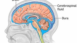 Hydrocephalus  Myelomeningocele  CNS Disorders [upl. by Warms305]