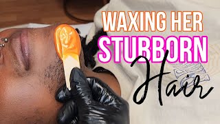 Waxing Stubborn Facial Hair Hirsutism [upl. by Yrevi]